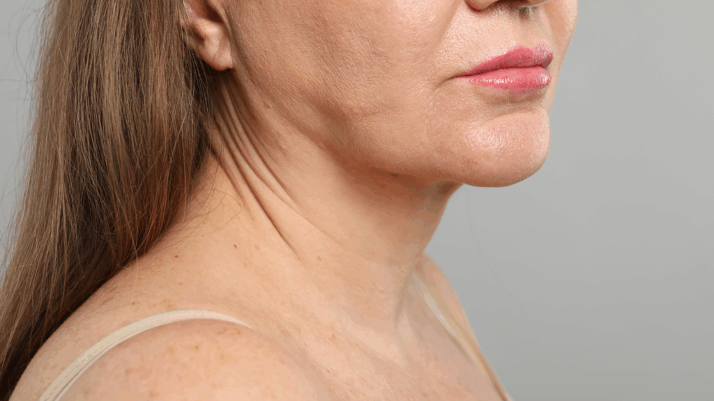 Lifting sans chirurgie Lyon