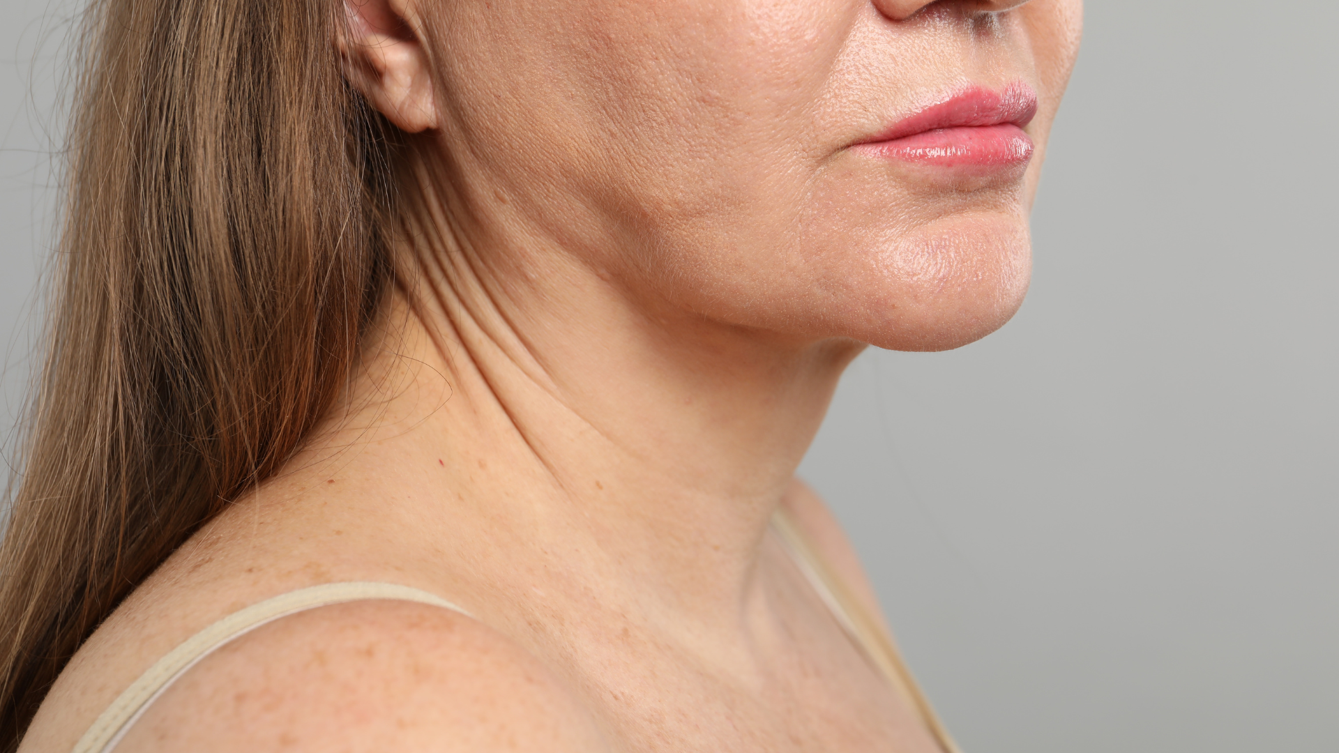 Lifting sans chirurgie Lyon