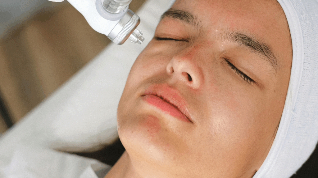 épilation définitive visage Lyon