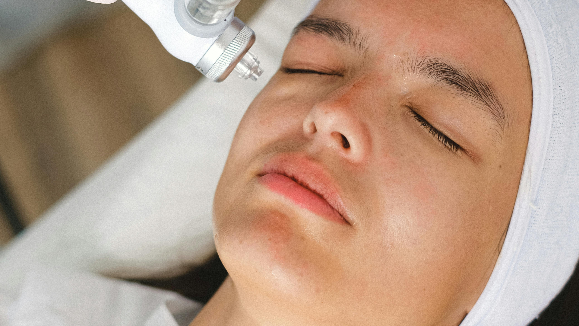 épilation définitive visage Lyon